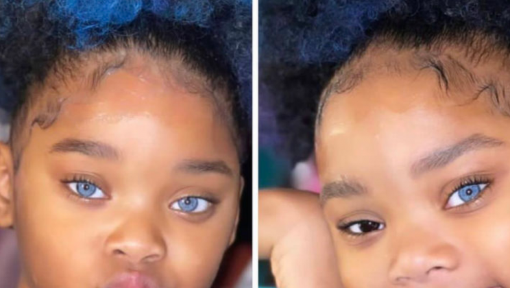 The ‘Blue Twins’ made headlines all over the world thanks to their amazing eyes – and this is how they look today