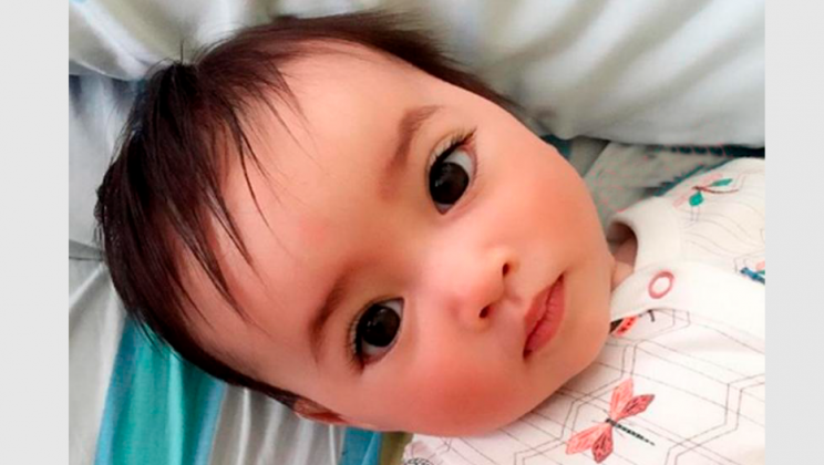 Five years ago, a baby girl was born with very beautiful eyes. How does the girl look now?