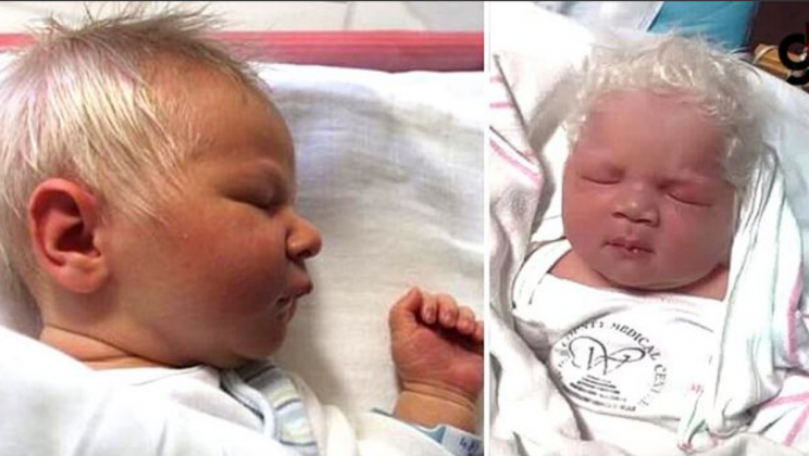 A baby was born with snow-white hair, when the doctors told the mother the reason, she was left speechless