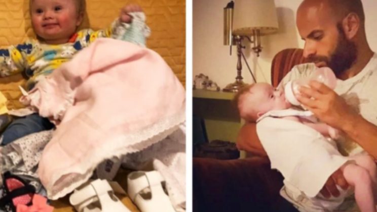 4 years ago, a man adopted an “unusual” girl who was disowned by 2 families: how the little girl looks and lives now