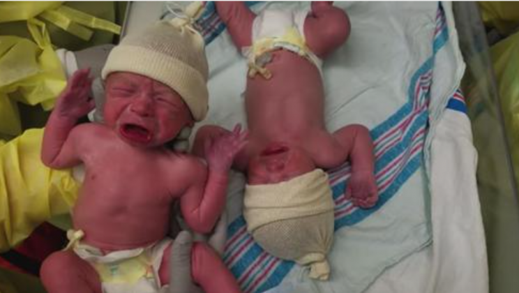 Moments After Birth Newborn Twins Astonish Everyone And Make Dad Run For The Camera