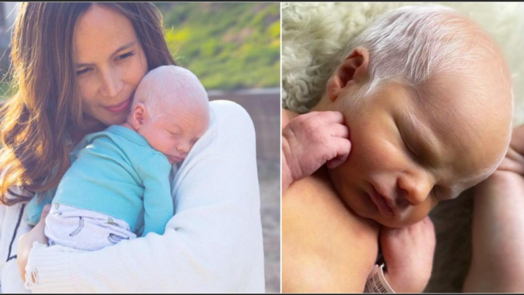 What a boy looks like now, who was born 9 years ago with gray hair like an old man