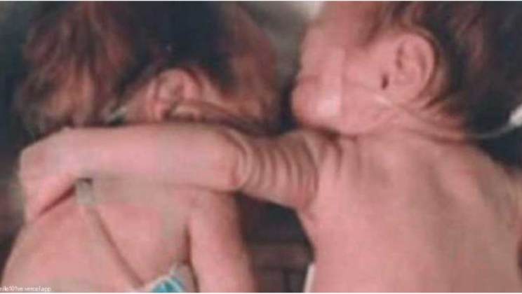 Nurse Places Dying Baby Next to Her Twin for Final Farewell, Then the World Witnessed a Miracle