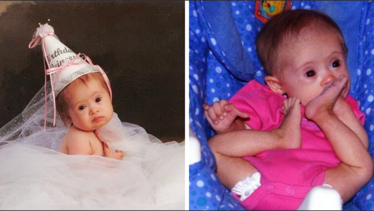 The woman was offered to abandon her daughter with Down syndrome, but she did not listen to them — and the girl became a model