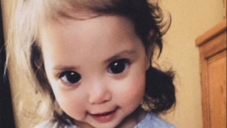 “What an unusual!”: How does a girl with huge eyes live