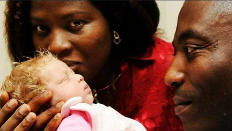 A Snow White was born 12 years ago in a Nigerian family, what does the girl look like now 