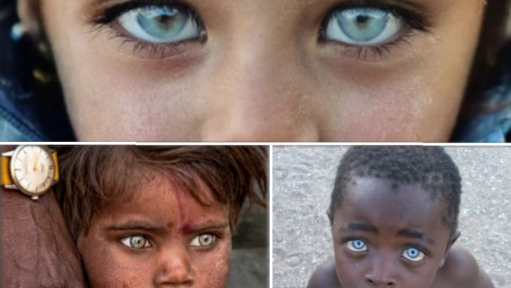 Top 10 unique photos of these babies’ eyes around the world that will melt your heart.