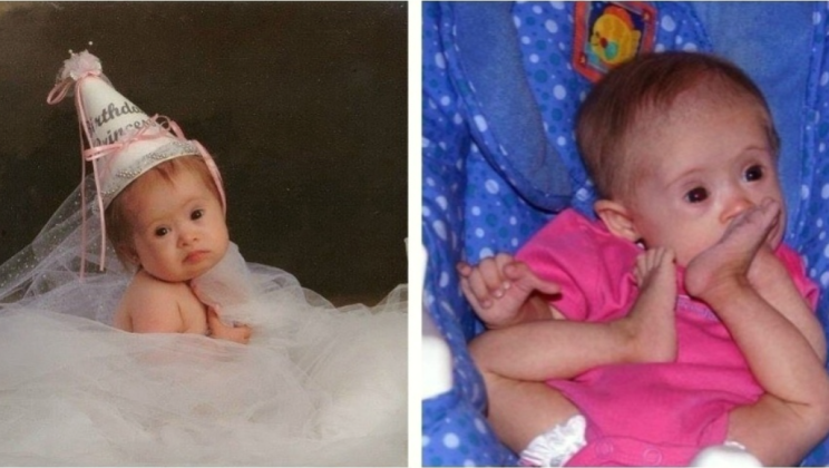 «Doctors advised the parents to abandon her. Here she is now!»: This is what the baby looks like now