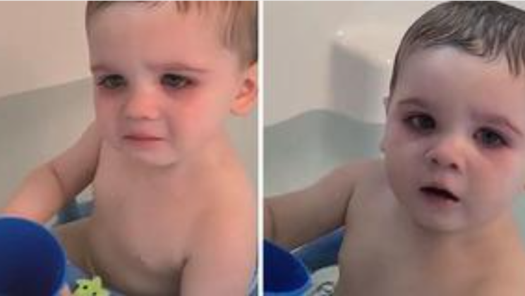 Mom Warns Parents About Bath Toys After Her Baby Nearly Lost His Sight